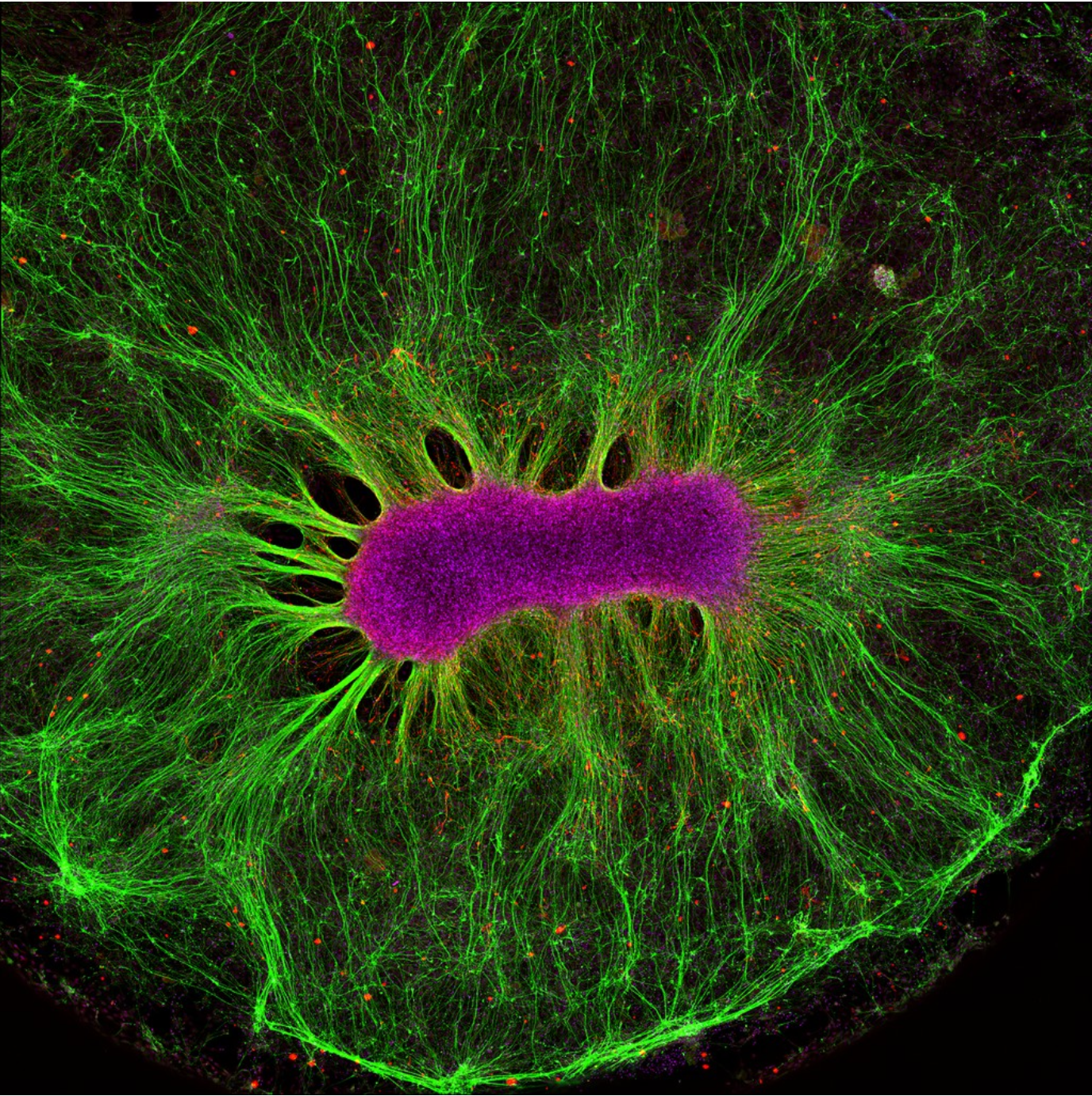The cerebral organoid enters its industrial era